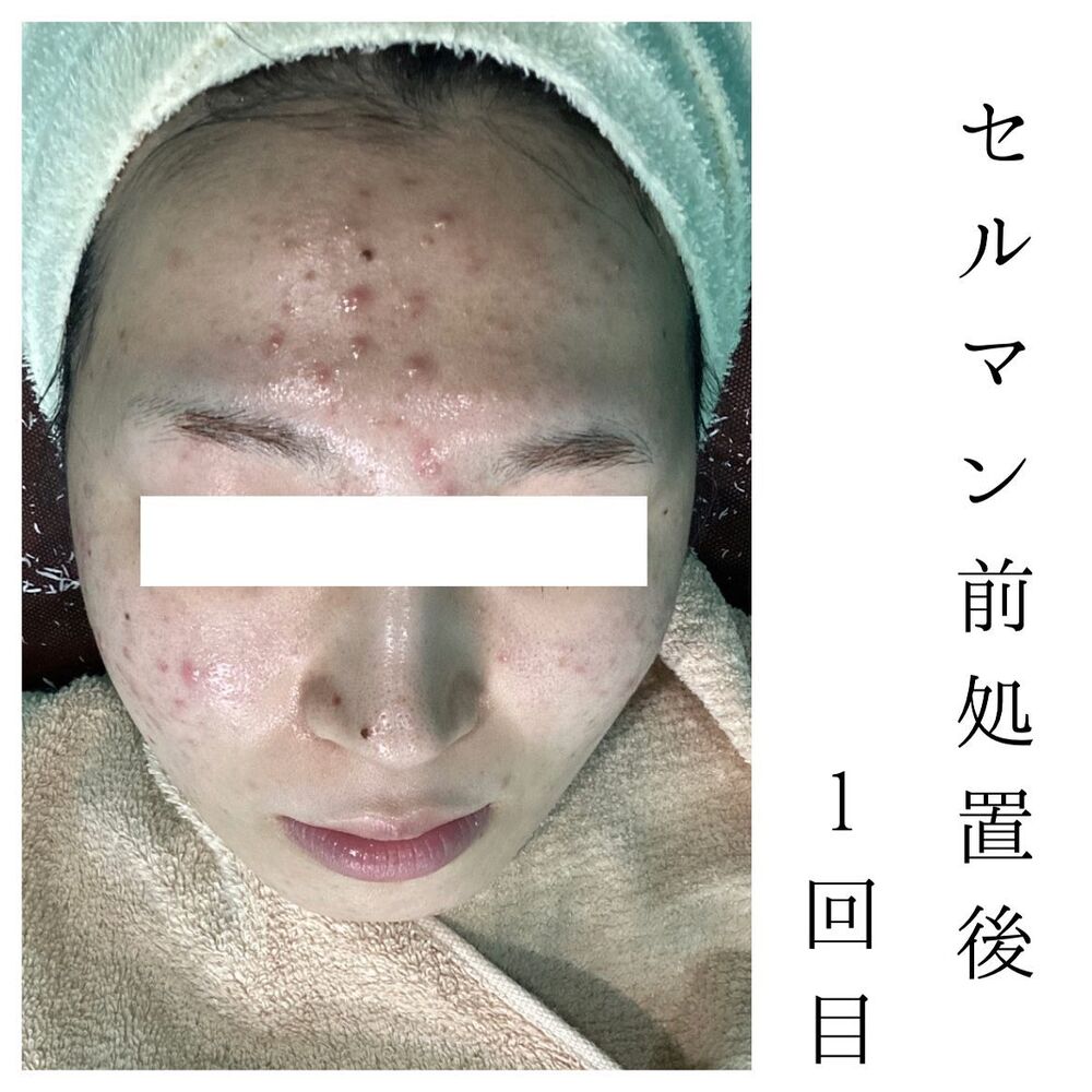 画像1342