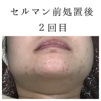 画像1394