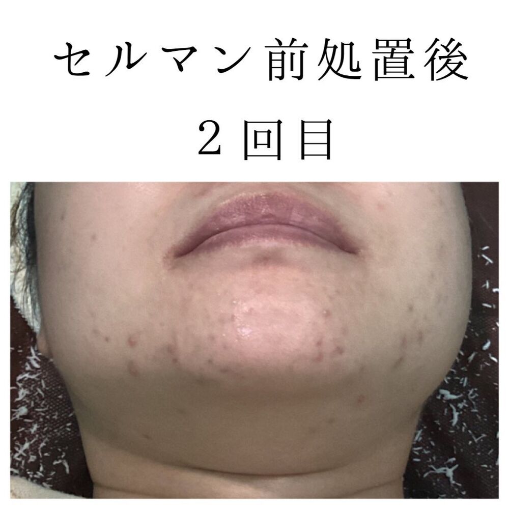 画像1394