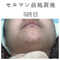 画像1397