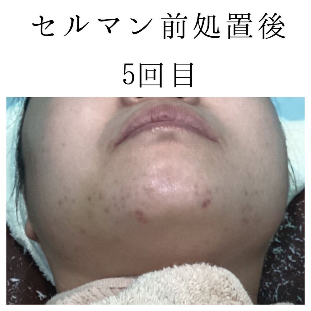 画像1397