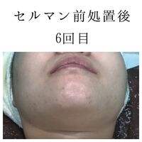 画像1400