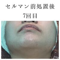 画像1403