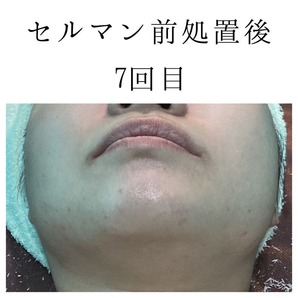 画像1403