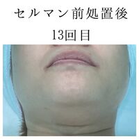 画像1406