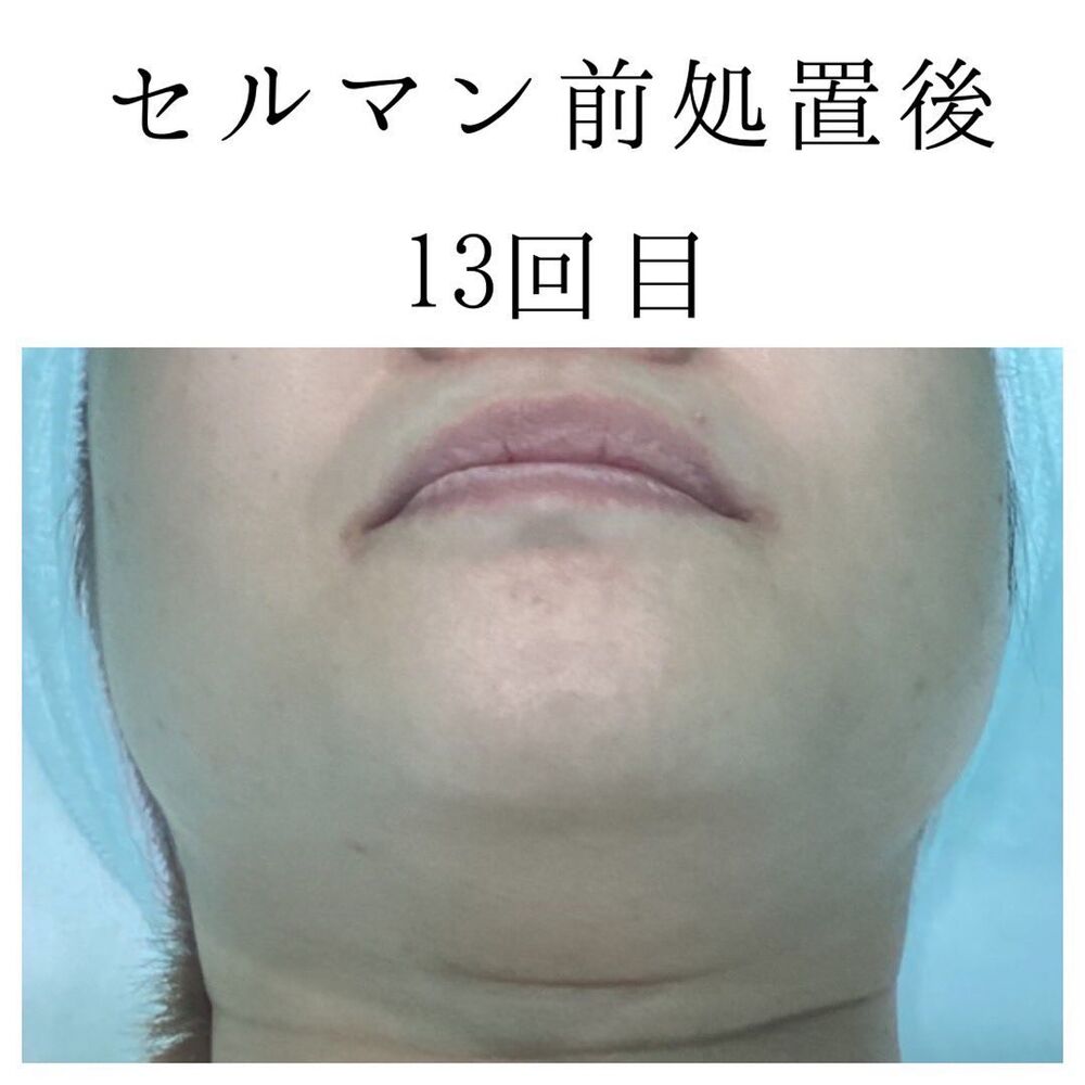 画像1406
