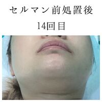 画像1409