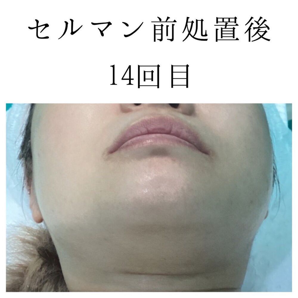 画像1409