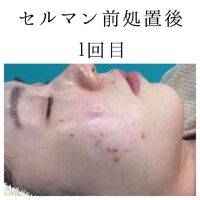 画像1412