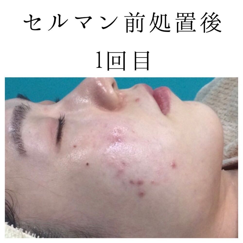 画像1412