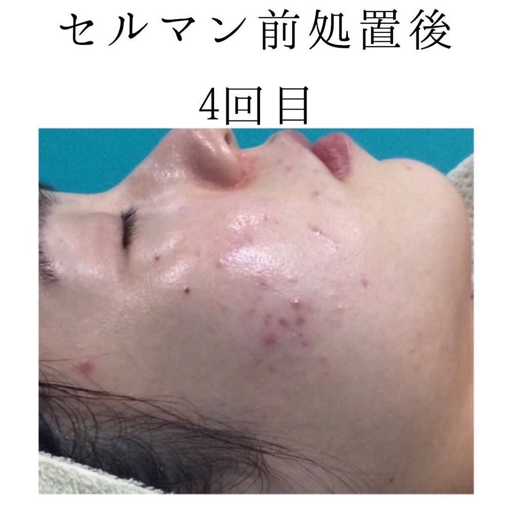 画像1415