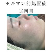 画像1418