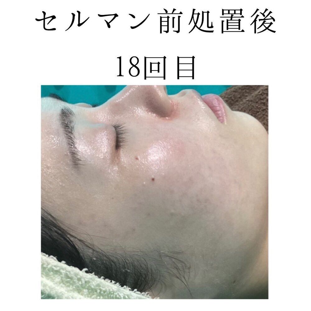 画像1418