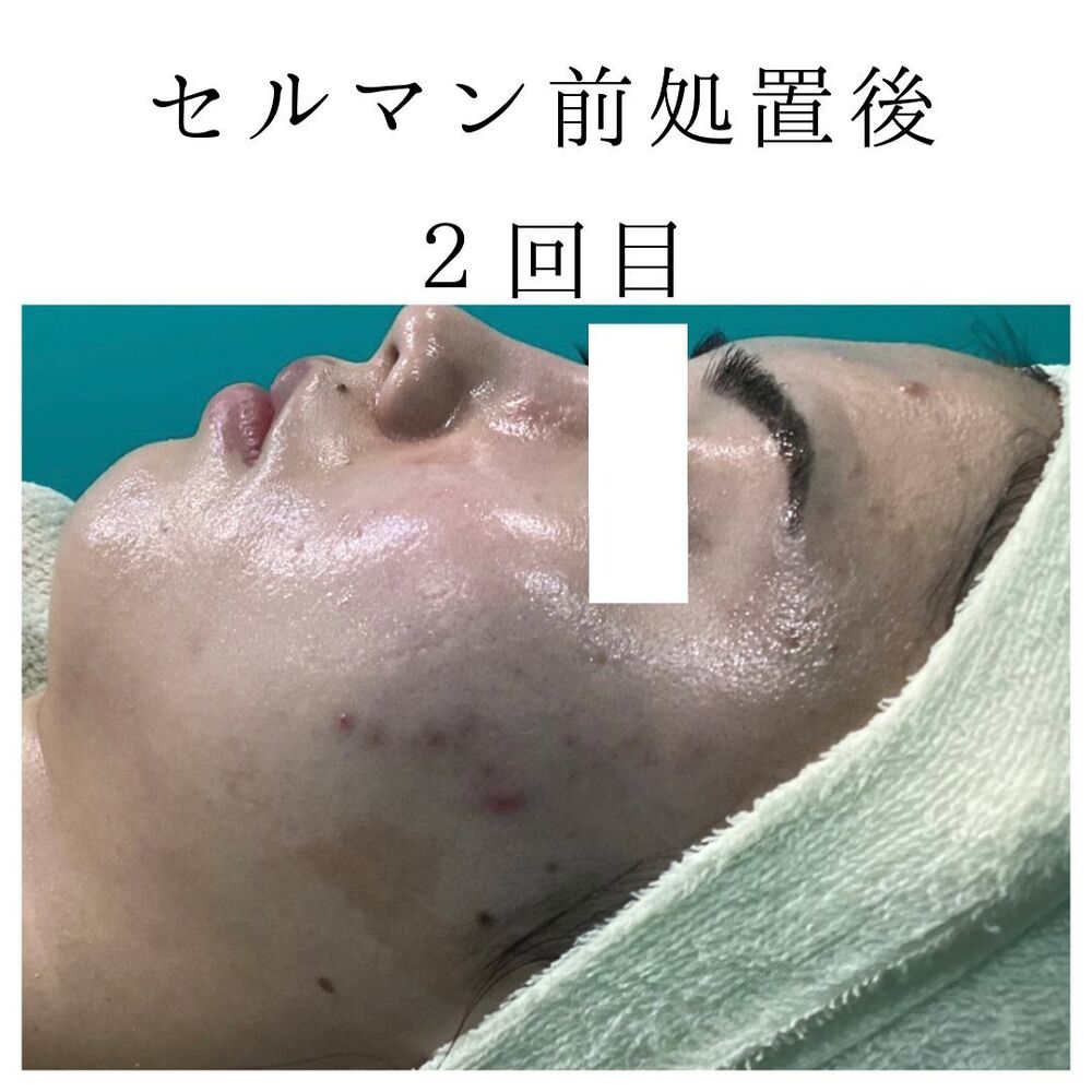 画像1424