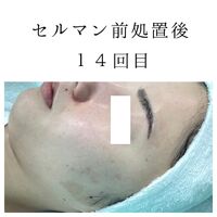 画像1427