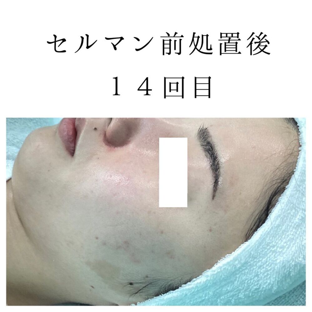 画像1427