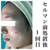 画像1441