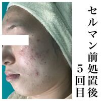 画像1444