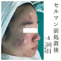 画像1479