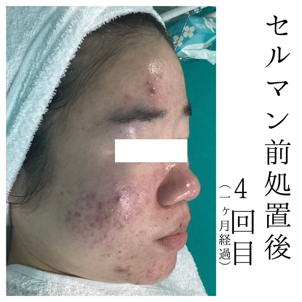 画像1479