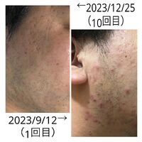 画像2010
