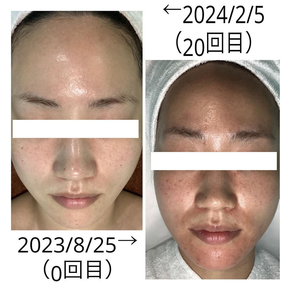 画像2055