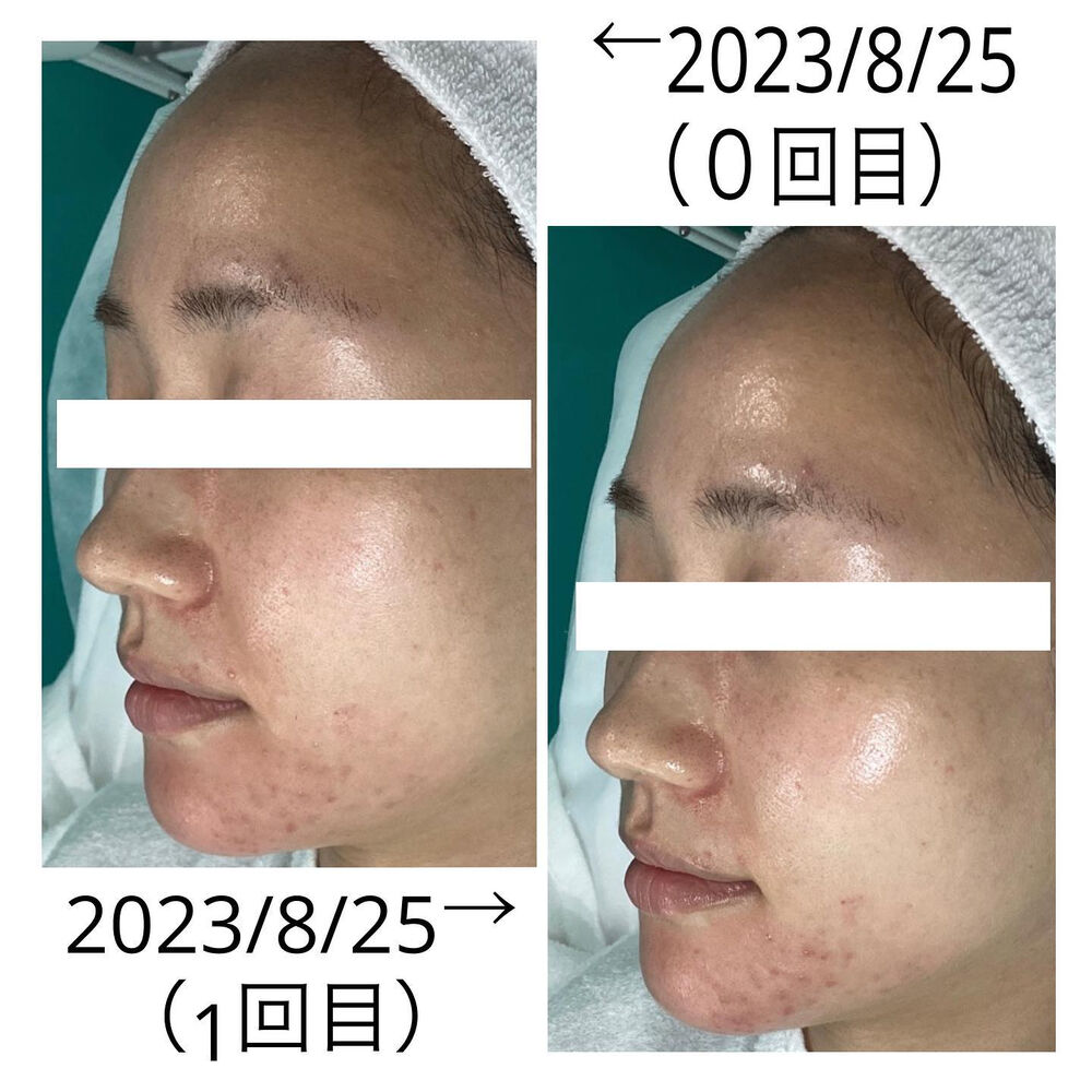 画像2057