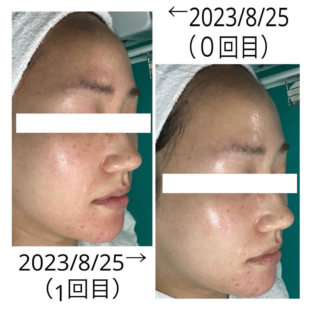 画像2060
