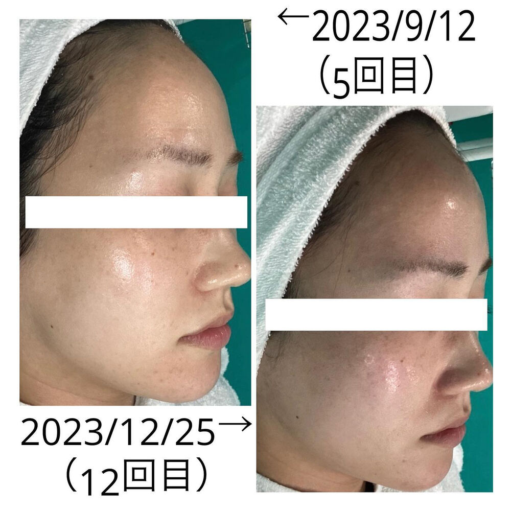 画像2061