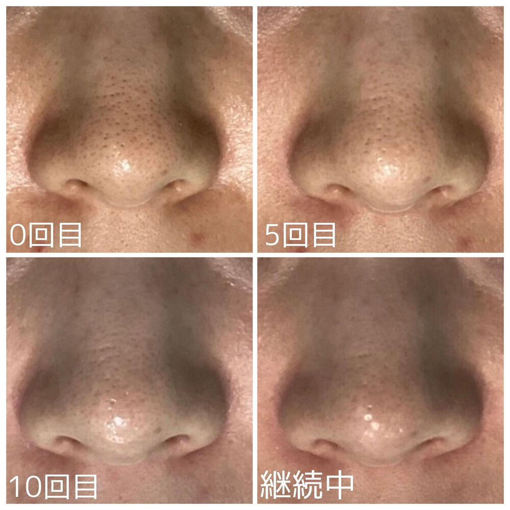 画像2114