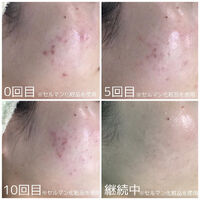 画像2138