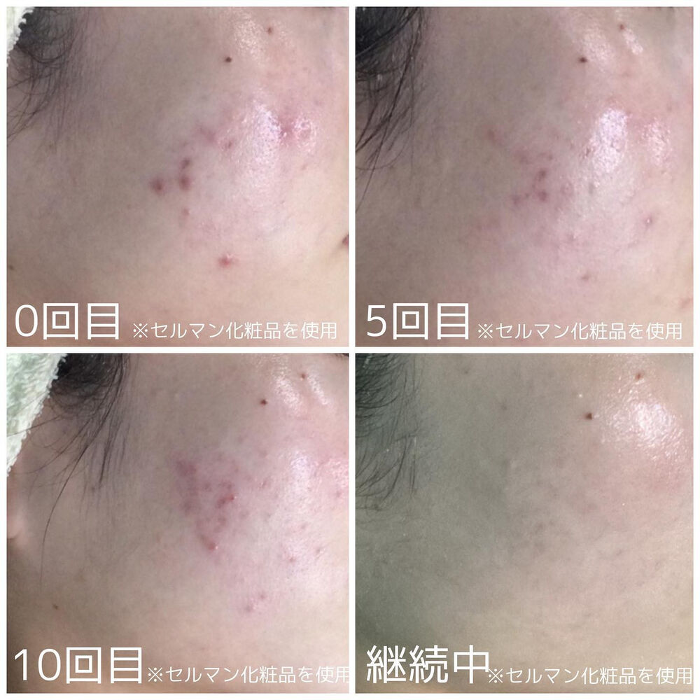 画像2138