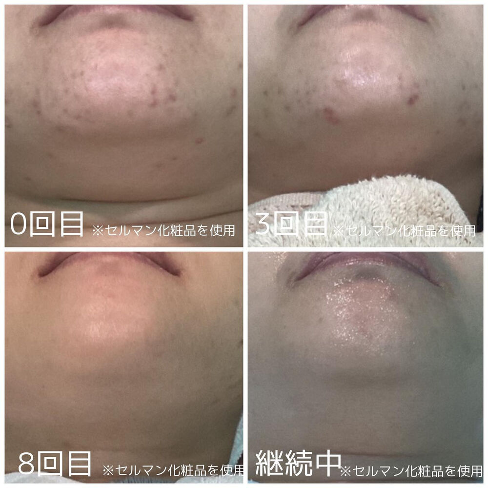 画像2142