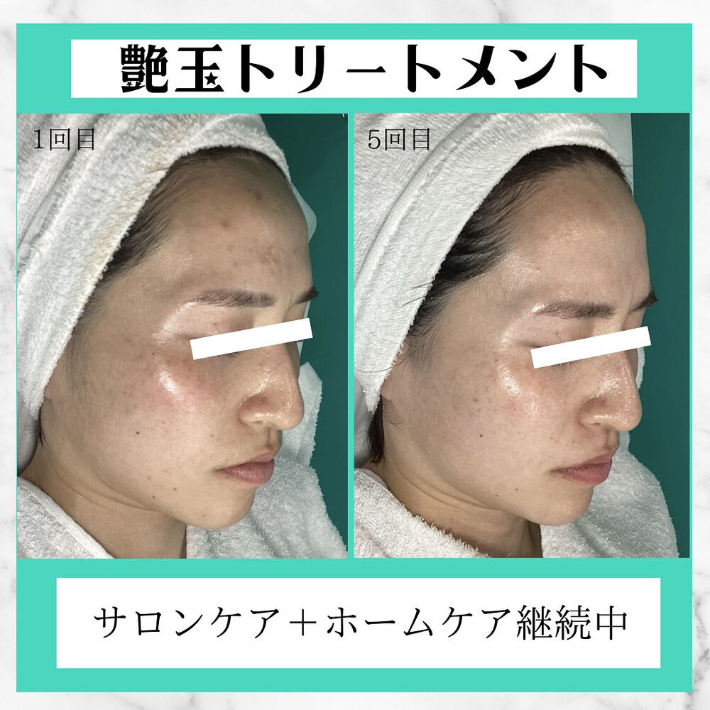 画像2530