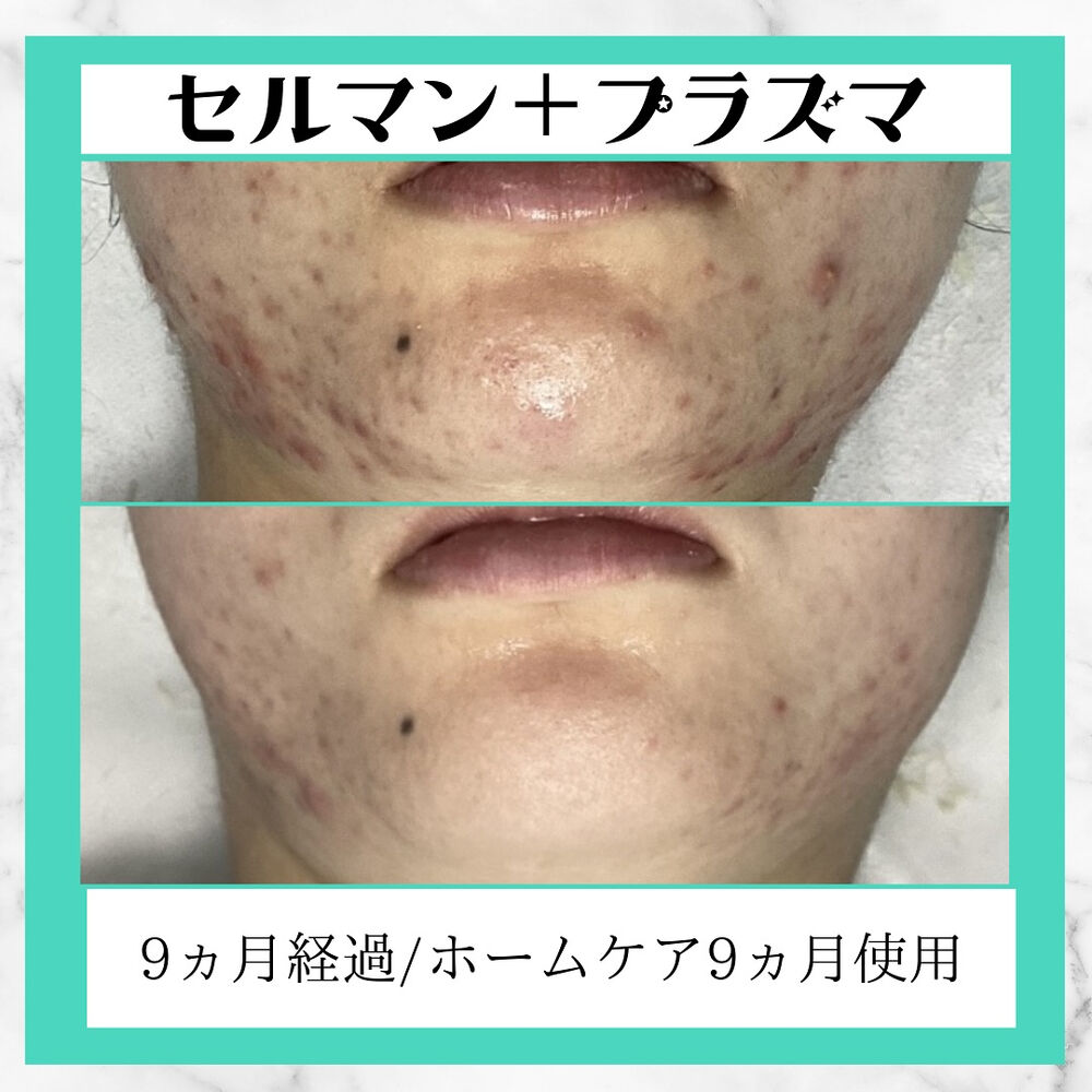 画像2556