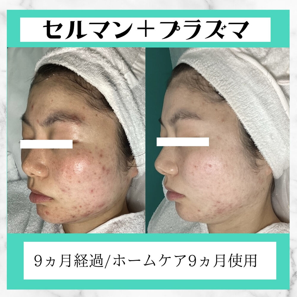 画像2558