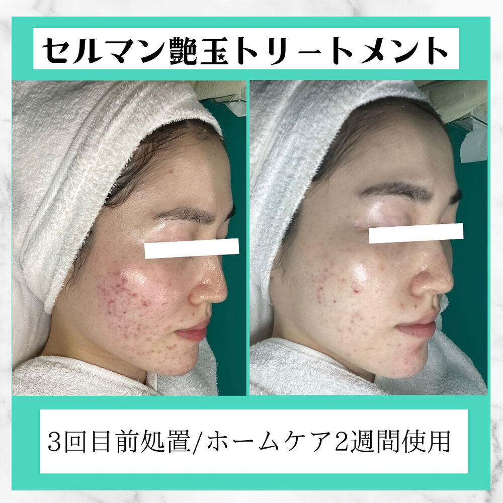 画像2578