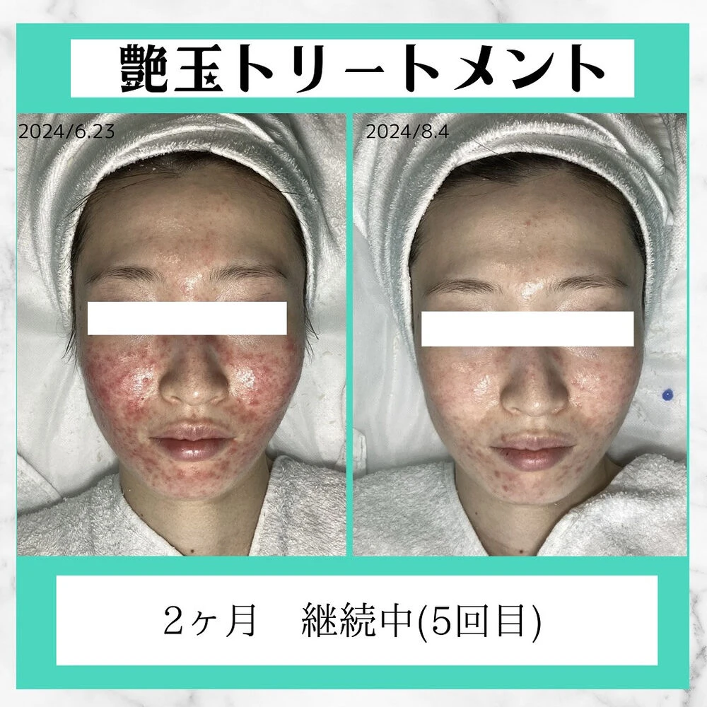 画像2783